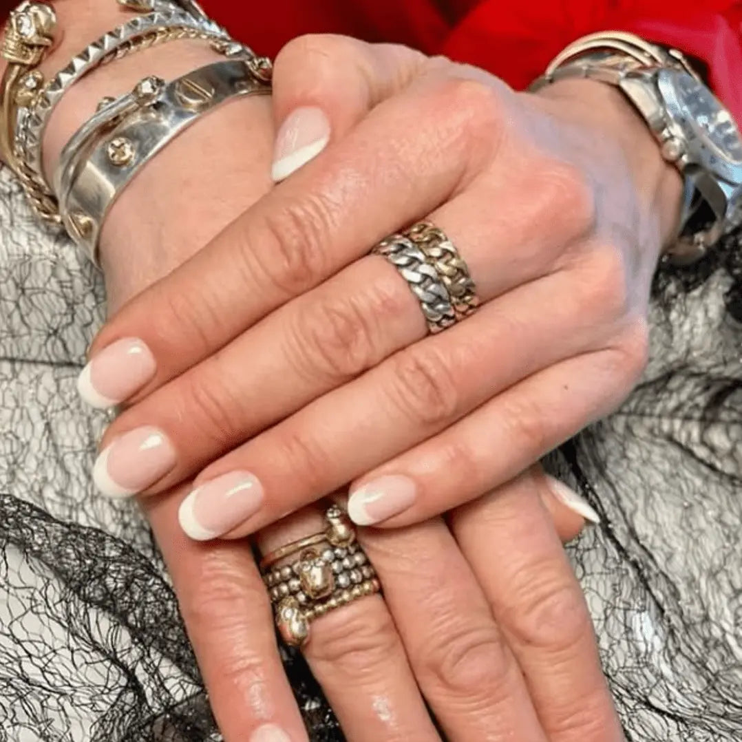 Kedjering - L8Hasselblad